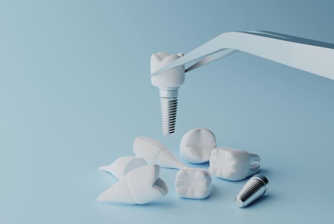 Falsi miti: implantologia dentale