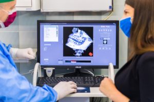 pianificazione digitale in implantologia dentale con TAC 3D