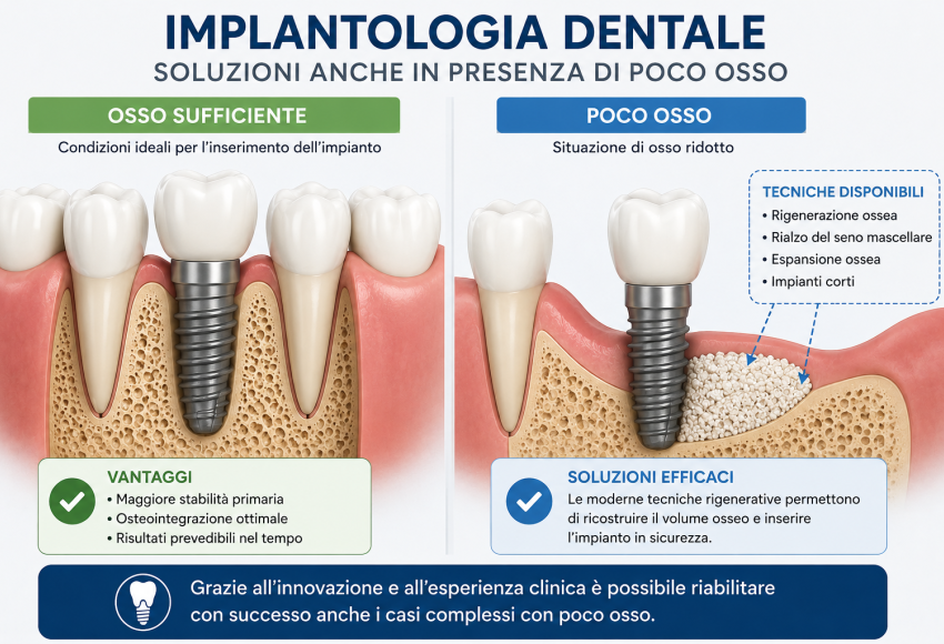 Implantologia infografica